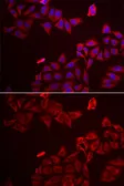 Anti-Galectin 8 antibody used in Immunocytochemistry/ Immunofluorescence (ICC/IF). GTX33214