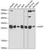 Anti-GAMT antibody used in Western Blot (WB). GTX33215