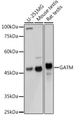 Anti-GATM antibody used in Western Blot (WB). GTX33216
