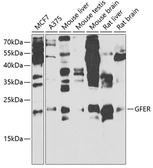 Anti-GFER antibody used in Western Blot (WB). GTX33219