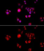 Anti-GLUD2 antibody used in Immunocytochemistry/ Immunofluorescence (ICC/IF). GTX33220
