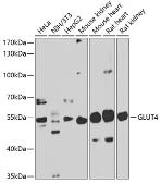 Anti-GLUT4 antibody used in Western Blot (WB). GTX33221