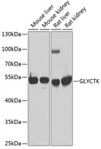 Anti-GLYCTK antibody used in Western Blot (WB). GTX33222