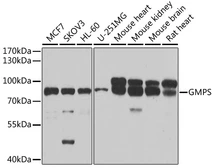Anti-GMP synthase antibody used in Western Blot (WB). GTX33223