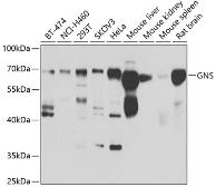 Anti-GNS antibody used in Western Blot (WB). GTX33224