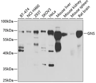 Anti-GNS antibody used in Western Blot (WB). GTX33224