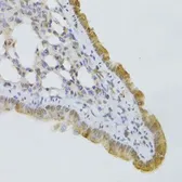 Anti-GPD2 antibody used in IHC (Paraffin sections) (IHC-P). GTX33225