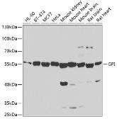 Anti-GPI antibody used in Western Blot (WB). GTX33226