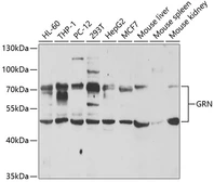 Anti-Granulins antibody used in Western Blot (WB). GTX33228