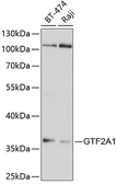 Anti-GTF2A1 antibody used in Western Blot (WB). GTX33231
