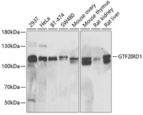 Anti-GTF2IRD1 antibody used in Western Blot (WB). GTX33232