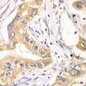 Anti-HAGH antibody used in IHC (Paraffin sections) (IHC-P). GTX33234