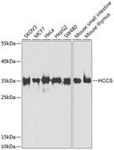 Anti-HCCS antibody used in Western Blot (WB). GTX33236