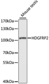 Anti-HDGFRP2 antibody used in Western Blot (WB). GTX33237