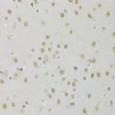 Anti-HEXIM1 antibody used in IHC (Paraffin sections) (IHC-P). GTX33240