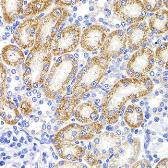 Anti-HMGCL antibody used in IHC (Paraffin sections) (IHC-P). GTX33242