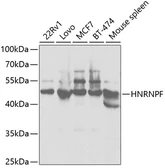 Anti-hnRNP F antibody used in Western Blot (WB). GTX33243