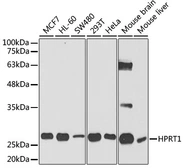 Anti-HPRT antibody used in Western Blot (WB). GTX33248