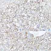 Anti-HSD17B13 antibody used in IHC (Paraffin sections) (IHC-P). GTX33250
