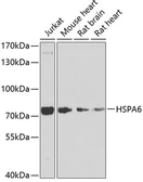 Anti-HSPA6 antibody used in Western Blot (WB). GTX33252