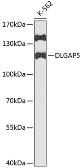 Anti-HURP antibody used in Western Blot (WB). GTX33253