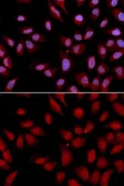 Anti-HURP antibody used in Immunocytochemistry/ Immunofluorescence (ICC/IF). GTX33253