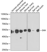 Anti-Ihh antibody used in Western Blot (WB). GTX33257