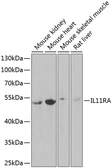 Anti-IL11RA antibody used in Western Blot (WB). GTX33258