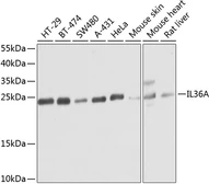 Anti-IL1F6 antibody used in Western Blot (WB). GTX33260