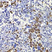 Anti-IL21 antibody used in IHC (Paraffin sections) (IHC-P). GTX33263