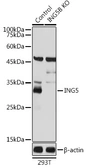 Anti-ING5 antibody used in Western Blot (WB). GTX33266