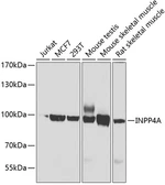 Anti-INPP4A antibody used in Western Blot (WB). GTX33268