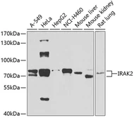 Anti-IRAK2 antibody used in Western Blot (WB). GTX33273