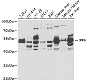 Anti-IRF6 antibody used in Western Blot (WB). GTX33275