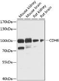 Anti-K-Cadherin antibody used in Western Blot (WB). GTX33279