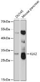 Anti-Kallikrein 2 antibody used in Western Blot (WB). GTX33281