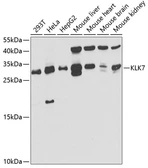 Anti-Kallikrein 7 antibody used in Western Blot (WB). GTX33289