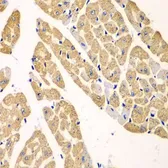 Anti-KYNU antibody used in IHC (Paraffin sections) (IHC-P). GTX33291