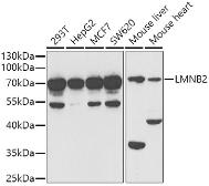 Anti-Lamin B2 antibody used in Western Blot (WB). GTX33292