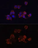 Anti-LAMP1 antibody used in Immunocytochemistry/ Immunofluorescence (ICC/IF). GTX33293