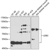 Anti-LDB3 antibody used in Western Blot (WB). GTX33294