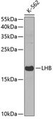 Anti-LH beta antibody used in Western Blot (WB). GTX33295