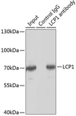 Anti-L-Plastin antibody used in Immunoprecipitation (IP). GTX33300