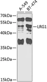 Anti-LRG1 antibody used in Western Blot (WB). GTX33301