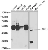Anti-LSM11 antibody used in Western Blot (WB). GTX33303