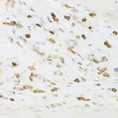 Anti-LSP1 antibody used in IHC (Paraffin sections) (IHC-P). GTX33304