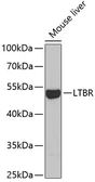 Anti-LTBR antibody used in Western Blot (WB). GTX33305