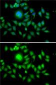 Anti-MATH1 antibody used in Immunocytochemistry/ Immunofluorescence (ICC/IF). GTX33306