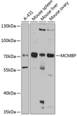 Anti-MCMBP antibody used in Western Blot (WB). GTX33311