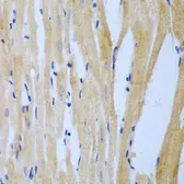 Anti-MGAT3 antibody used in IHC (Paraffin sections) (IHC-P). GTX33317